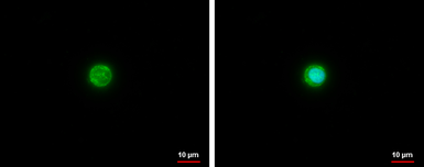 Anti-Apolipoprotein E antibody [C2C3], C-term used in Immunocytochemistry/ Immunofluorescence (ICC/IF). GTX100053