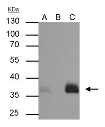 Anti-Apolipoprotein E antibody [C2C3], C-term used in Immunoprecipitation (IP). GTX100053
