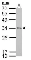 Anti-Apolipoprotein E antibody [C2C3], C-term used in Western Blot (WB). GTX100053