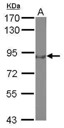 Anti-FOXO3A antibody [C3], C-term used in Western Blot (WB). GTX100277