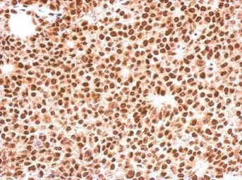 Anti-FOXO3A antibody [C3], C-term used in IHC (Paraffin sections) (IHC-P). GTX100277