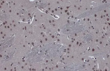 Anti-FOXO3A antibody [C3], C-term used in IHC (Paraffin sections) (IHC-P). GTX100277