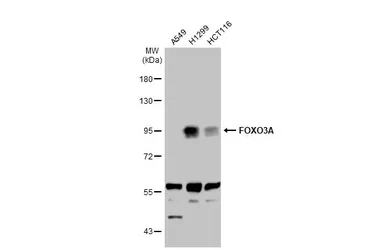Anti-FOXO3A antibody [C3], C-term used in Western Blot (WB). GTX100277
