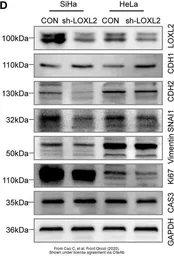 Anti-E-Cadherin antibody used in Western Blot (WB). GTX100443