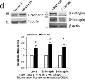 Anti-E-Cadherin antibody used in Western Blot (WB). GTX100443