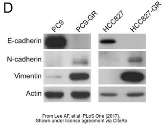 Anti-E-Cadherin antibody used in Western Blot (WB). GTX100443