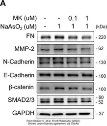 Anti-E-Cadherin antibody used in Western Blot (WB). GTX100443