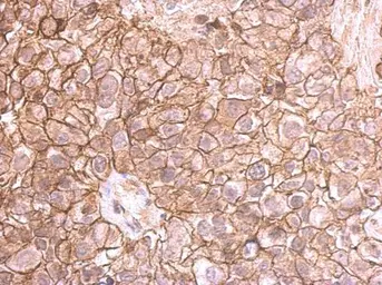 Anti-E-Cadherin antibody used in IHC (Paraffin sections) (IHC-P). GTX100443