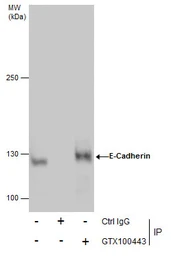 Anti-E-Cadherin antibody used in Immunoprecipitation (IP). GTX100443