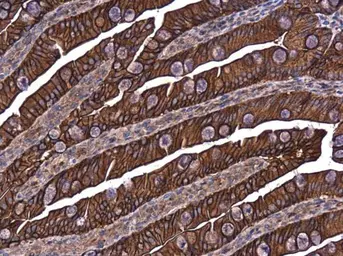 Anti-E-Cadherin antibody used in IHC (Paraffin sections) (IHC-P). GTX100443