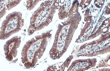 Anti-E-Cadherin antibody used in IHC (Paraffin sections) (IHC-P). GTX100443