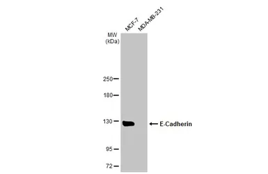 Anti-E-Cadherin antibody used in Western Blot (WB). GTX100443