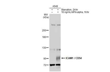 Anti-ICAM1 / CD54 antibody [N1C2] used in Western Blot (WB). GTX100450