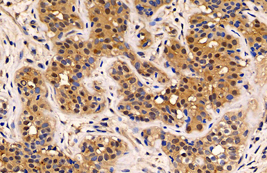 Anti-MUC1 antibody used in IHC (Paraffin sections) (IHC-P). GTX100459