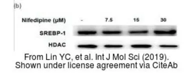 Anti-HDAC1 antibody used in Western Blot (WB). GTX100513