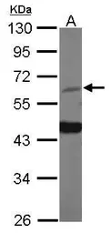 Anti-HDAC1 antibody used in Western Blot (WB). GTX100513