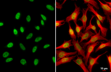 Anti-HDAC1 antibody used in Immunocytochemistry/ Immunofluorescence (ICC/IF). GTX100513