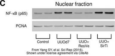 Anti-PCNA antibody used in Western Blot (WB). GTX100539