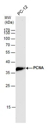Anti-PCNA antibody used in Western Blot (WB). GTX100539