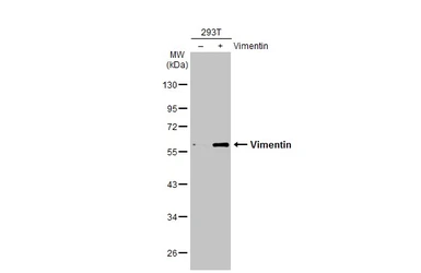 Anti-Vimentin antibody used in Western Blot (WB). GTX100619