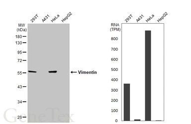 Anti-Vimentin antibody used in Western Blot (WB). GTX100619