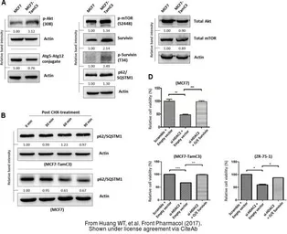 Anti-SQSTM1 / P62 antibody [N3C1], Internal used in Western Blot (WB). GTX100685