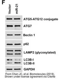 Anti-SQSTM1 / P62 antibody [N3C1], Internal used in Western Blot (WB). GTX100685