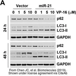 Anti-SQSTM1 / P62 antibody [N3C1], Internal used in Western Blot (WB). GTX100685