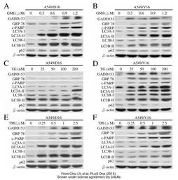 Anti-SQSTM1 / P62 antibody [N3C1], Internal used in Western Blot (WB). GTX100685