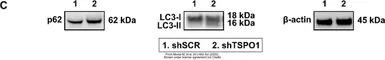 Anti-SQSTM1 / P62 antibody [N3C1], Internal used in Western Blot (WB). GTX100685