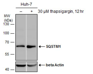 Anti-SQSTM1 / P62 antibody [N3C1], Internal used in Western Blot (WB). GTX100685