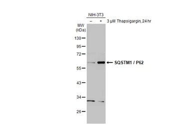 Anti-SQSTM1 / P62 antibody [N3C1], Internal used in Western Blot (WB). GTX100685