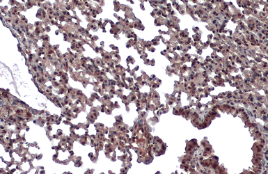 Anti-Von Hippel Lindau antibody used in IHC (Paraffin sections) (IHC-P). GTX101087