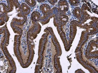 Anti-Prohibitin antibody used in IHC (Paraffin sections) (IHC-P). GTX101105