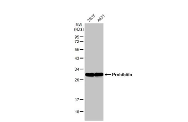 Anti-Prohibitin antibody used in Western Blot (WB). GTX101105