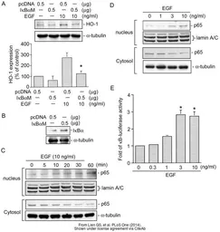 Anti-Lamin A + C antibody used in Western Blot (WB). GTX101127