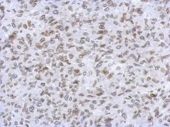 Anti-Lamin A + C antibody used in IHC (Paraffin sections) (IHC-P). GTX101127