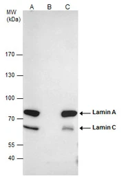 Anti-Lamin A + C antibody used in Immunoprecipitation (IP). GTX101127