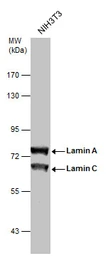 Anti-Lamin A + C antibody used in Western Blot (WB). GTX101127