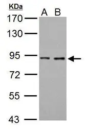 Anti-Prothrombin antibody used in Western Blot (WB). GTX101199