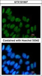 Anti-SOX2 antibody [N1C3] used in Immunocytochemistry/ Immunofluorescence (ICC/IF). GTX101507