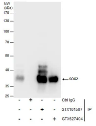 Anti-SOX2 antibody [N1C3] used in Immunoprecipitation (IP). GTX101507