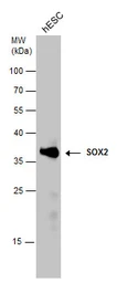 Anti-SOX2 antibody [N1C3] used in Western Blot (WB). GTX101507
