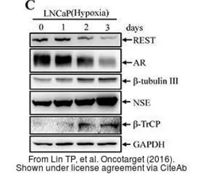 Anti-NSE antibody [N1C1] used in Western Blot (WB). GTX101553
