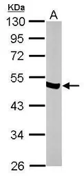 Anti-NSE antibody [N1C1] used in Western Blot (WB). GTX101553