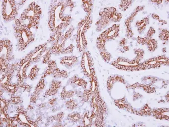 Anti-IL3 Receptor alpha antibody [N2C2], Internal used in IHC (Paraffin sections) (IHC-P). GTX101563