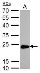 Anti-Transgelin antibody used in Western Blot (WB). GTX101608