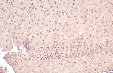Anti-AChE antibody used in IHC (Paraffin sections) (IHC-P). GTX101648