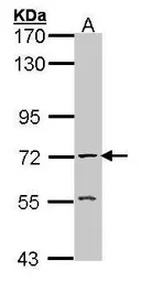 Anti-AChE antibody used in Western Blot (WB). GTX101648