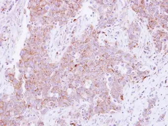 Anti-CD81 antibody used in IHC (Paraffin sections) (IHC-P). GTX101766